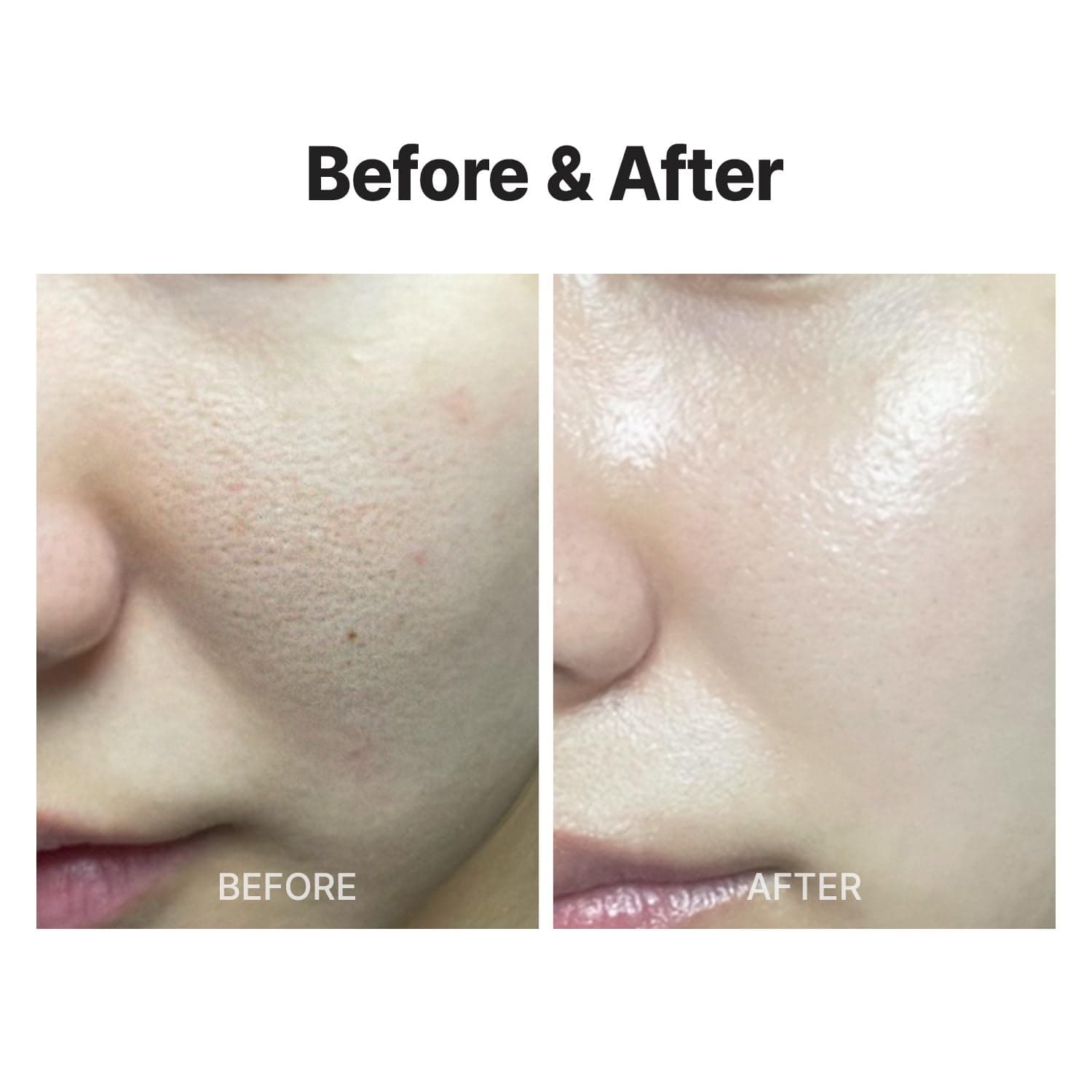 MEDITHERAPY Wrinkle fit Korean Mesh Sheet Masks (7EA), Collagen Mesh Sheet Mask for Glowing Skin, Daily Facial Mask, Hyaluronic acid Facial Mask, Korean Skincare