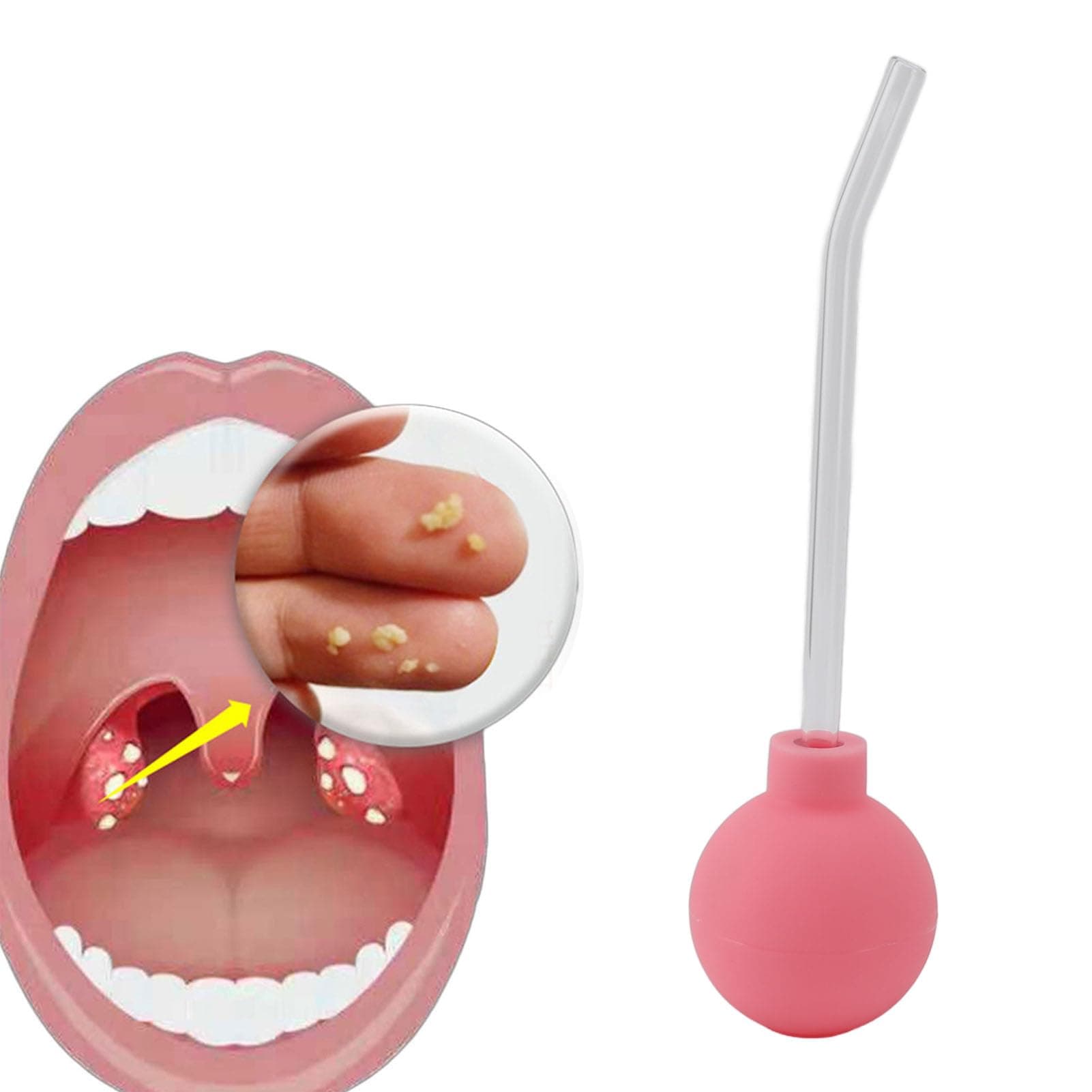 Tonsil Stone Remover,Tonsil Stone Remover Vacuum for Bad Breath Treatment,Tonsil Stone Suction Tool,Bad Breath Treatment for Adults,Throat Suction Tube Mouth Cleaner (Pink)
