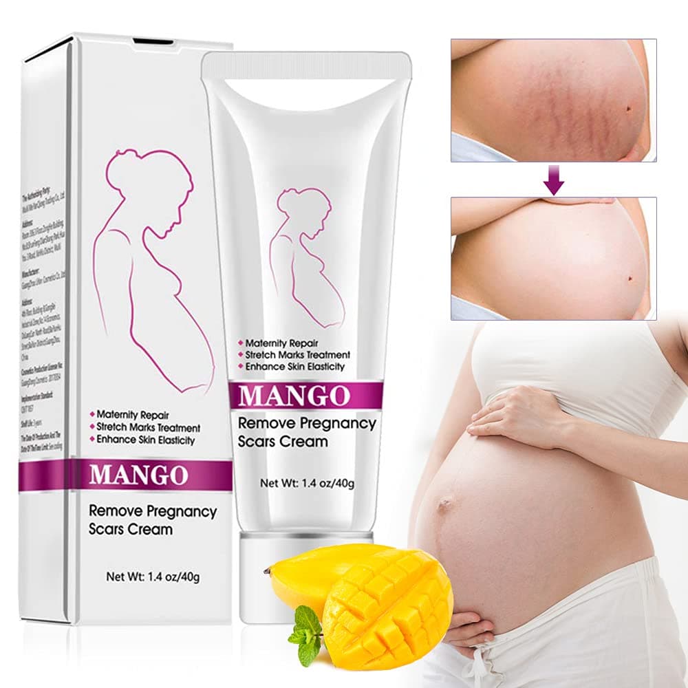 Stretch Mark Cream Scar Removal Cream Rapidly Eliminates Scars Maternity Stretch Mark Prevention Cream, Recovery Elasticity, Repair Scar Slack Line Abdomen Stretch Marks Postpartum