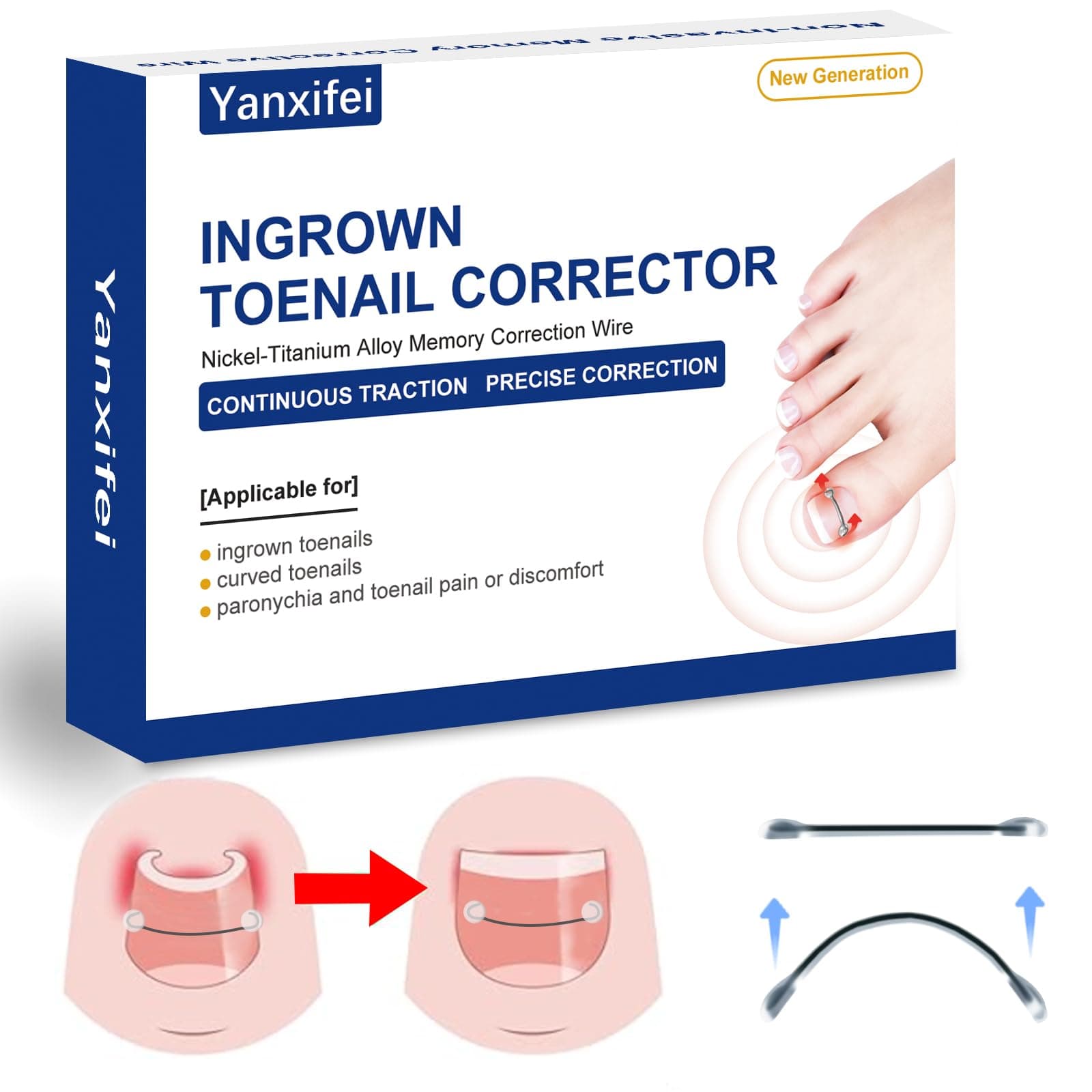 Nitinol Ingrown Toenail Corrector,at Home Ingrown Toenail Treatment,Curved Toenail Straightener,Ingrown Toe Nail Relief，Ingrown Toenail Removal Kit (11/16 In,13/16 In)