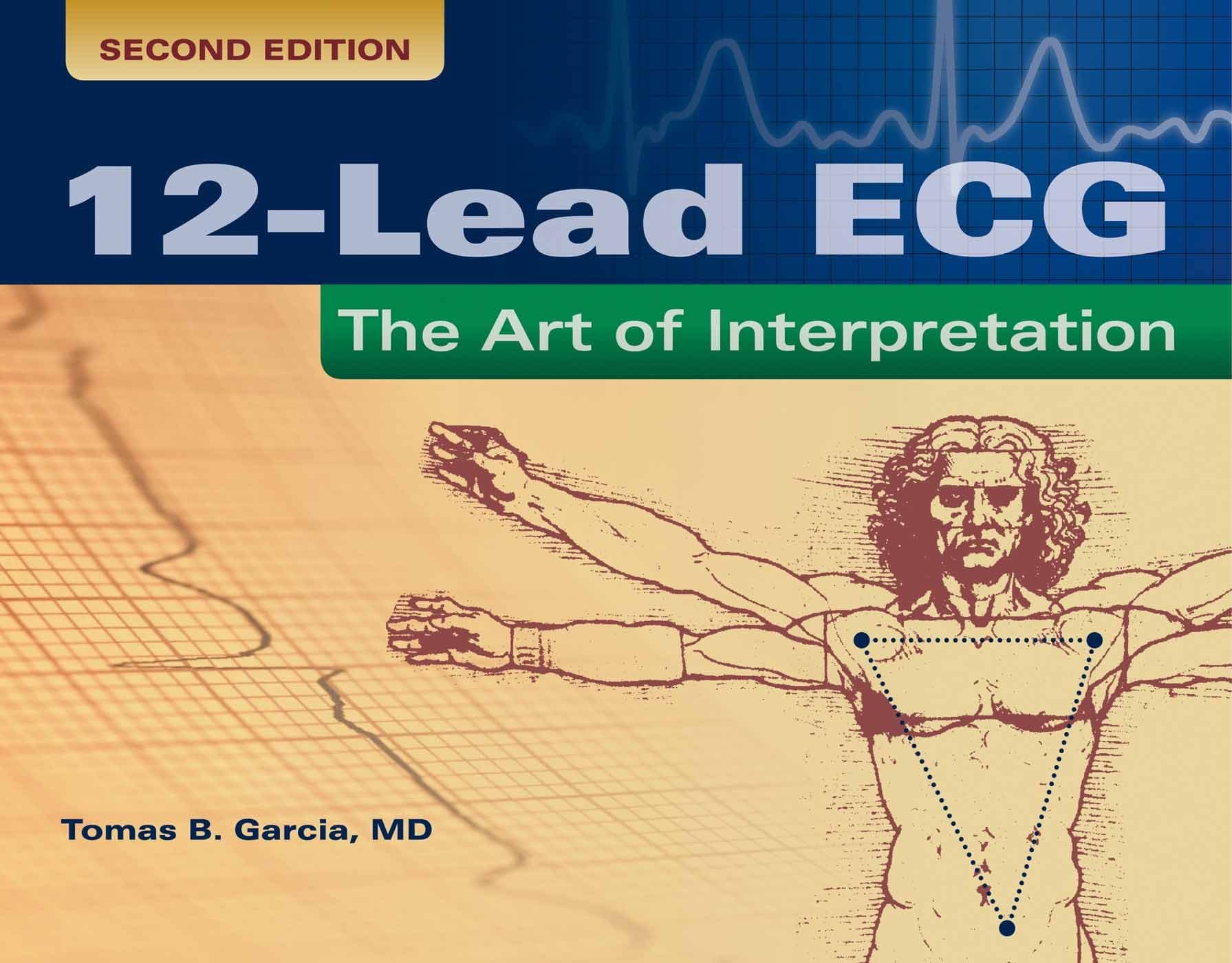 12-Lead ECG: The Art of Interpretation: . (Garcia, Introduction to 12-Lead ECG)