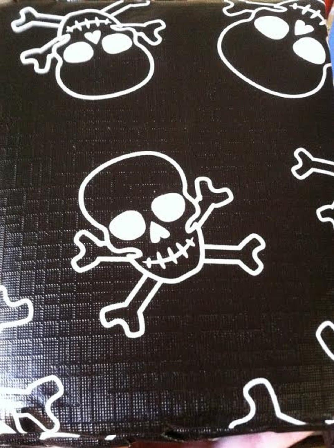 NBCT Facial Anti-Wrinkle Strips, Smoothing and Lifting Forehead Wrinkle Patches, Medium Size, 5 pcs, Silicone Hydrogel Patch