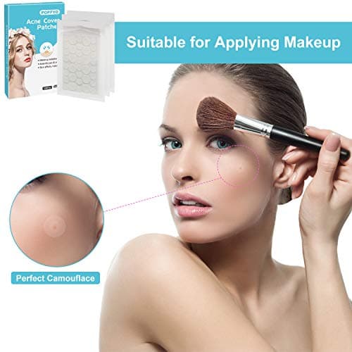 Acne Patch(108 Count), Poppyo Acne Care Pimple Patch Absorbing Round Pads, Blemish Covers - Hydrocolloid Bandages(2 sizes), Acne Spot Treatment for Face & Skin Spot Patch That Conceals Acne