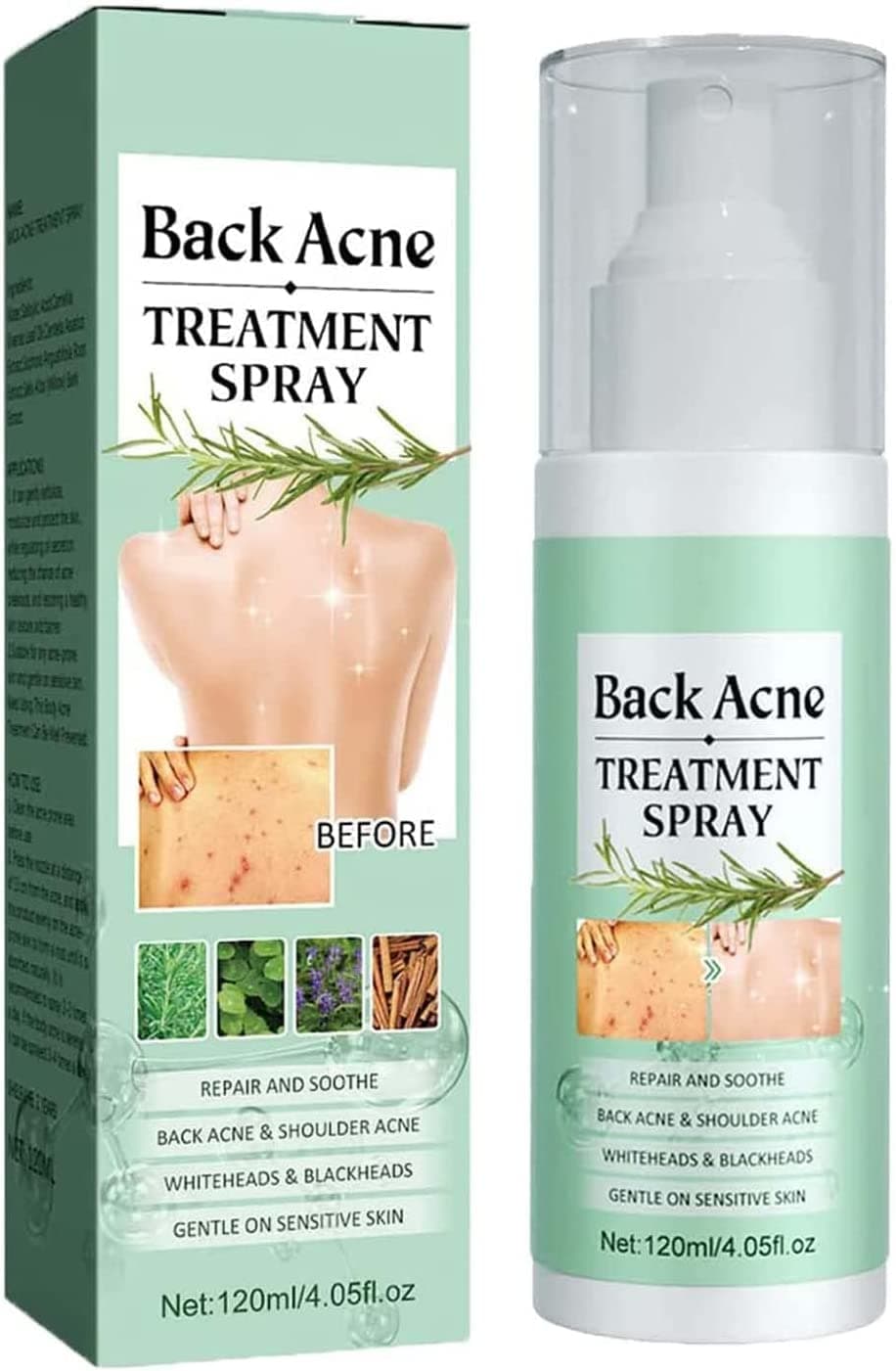 Toxiklenz Back Acne Treatment Spray, Herbaluxy Blackhead Extraction Cream - Mild and Non-Irritating for Back and Chest (1pcs)